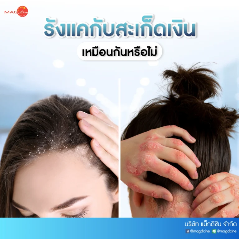 21 บทความ