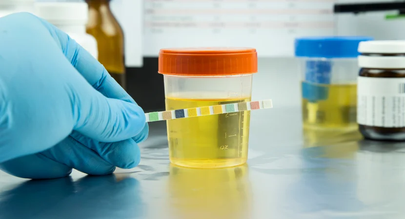 ชุดตรวจสารเสพติด