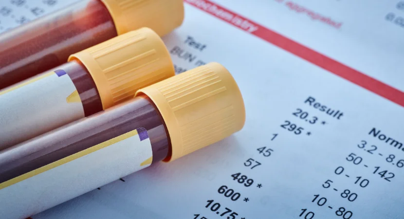 วิธีวางแผนงบประมาณซื้อชุดตรวจสารเสพติด