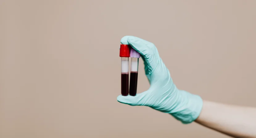 ตรวจสารเสพติดหลังใช้ยาแก้หวัด/ยาแก้ปวด เสี่ยงผลหลอกไหม? แนวทางป้องกันที่ควรรู้ 3 ที่ตรวจสารเสพติด