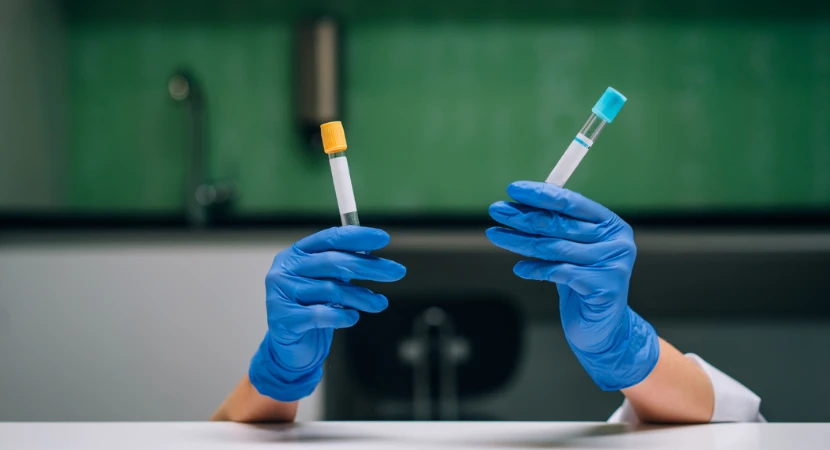 ชุดตรวจสารเสพติดกับการคัดกรองความปลอดภัยในองค์กรสำคัญอย่างไร 1 ชุดตรวจสารเสพติดกับการคัดกรองความปลอดภัยในองค์กรสำคัญอย่างไร