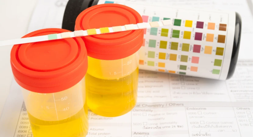 วิธีลดความสับสนเมื่อใช้ชุดตรวจสารเสพติดหลายรุ่นในองค์กรเดียวกัน | คู่มือใช้งานให้แม่นยำ 1 วิธีลดความสับสนเมื่อใช้ชุดตรวจสารเสพติด