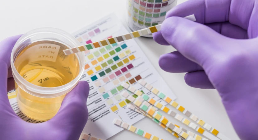 5 ขั้นตอนใช้ชุดตรวจสารเสพติดแบบปัสสาวะสำหรับมือใหม่ (เข้าใจง่าย ใช้ได้จริง อัปเดต 2026) 1 ขั้นตอนใช้ชุดตรวจสารเสพติด