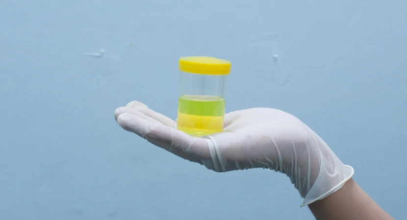 5 ขั้นตอนใช้ชุดตรวจสารเสพติดแบบปัสสาวะสำหรับมือใหม่ (เข้าใจง่าย ใช้ได้จริง อัปเดต 2026) 2 ขั้นตอนใช้ชุดตรวจสารเสพติด