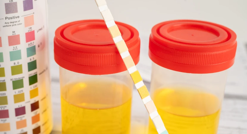 9 เทคนิคเลือกชุดตรวจสารเสพติดสำหรับตรวจพนักงานใหม่ (คู่มือสำหรับ HR และองค์กร อัปเดต 2026) 2 เทคนิคเลือกชุดตรวจสารเสพติด