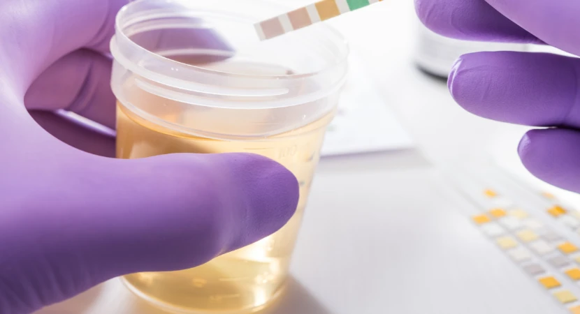 9 เทคนิคเลือกชุดตรวจสารเสพติดสำหรับตรวจพนักงานใหม่ (คู่มือสำหรับ HR และองค์กร อัปเดต 2026) 1 เทคนิคเลือกชุดตรวจสารเสพติด