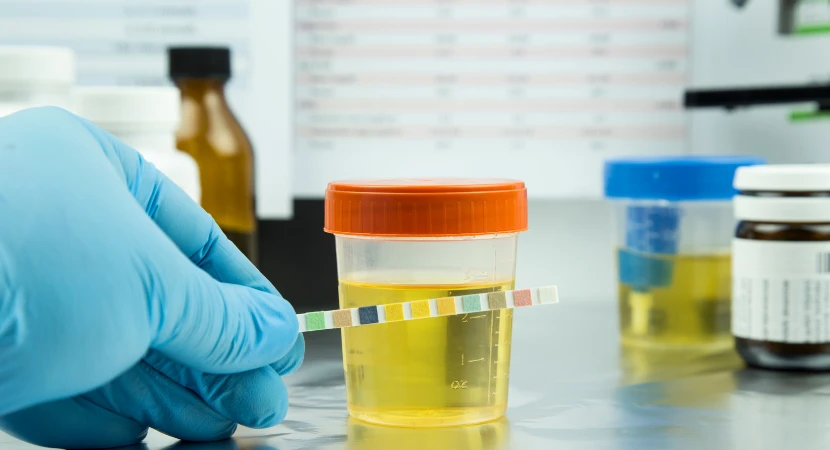 วิธีดูแลการเก็บตัวอย่างให้เหมาะกับการตรวจสารเสพติด