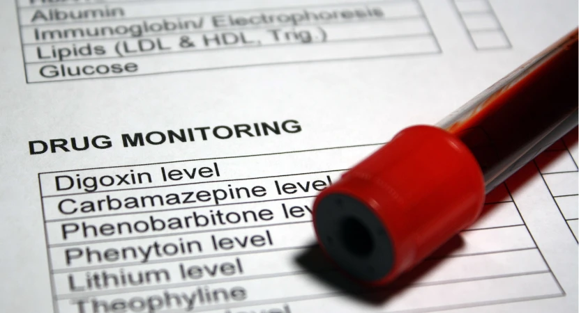 จุดที่ต้องเช็กก่อนใช้ชุดตรวจสารเสพติด