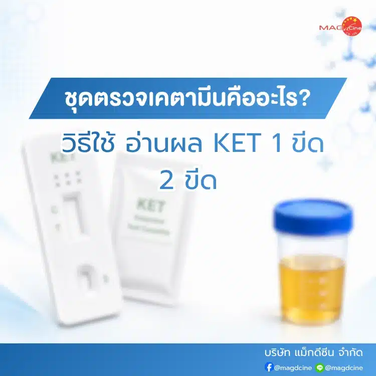 ชุดตรวจเคตามีนคืออะไร
