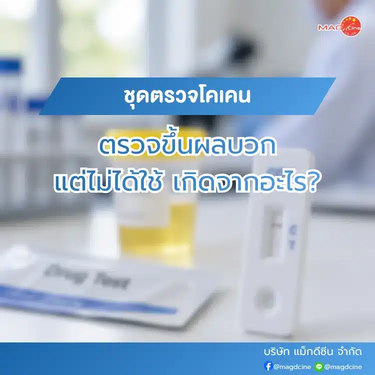 ชุดตรวจโคเคน