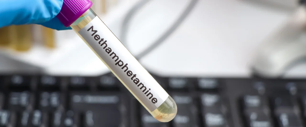 ชุดตรวจยาไอซ์