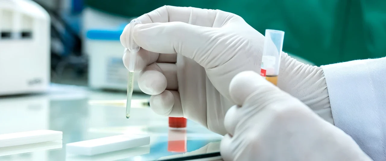 ชุดตรวจสารเสพติด