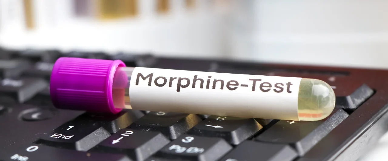ชุดตรวจมอร์ฟีน