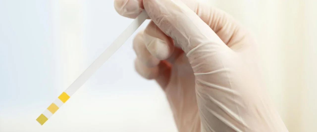 ชุดตรวจยาบ้า