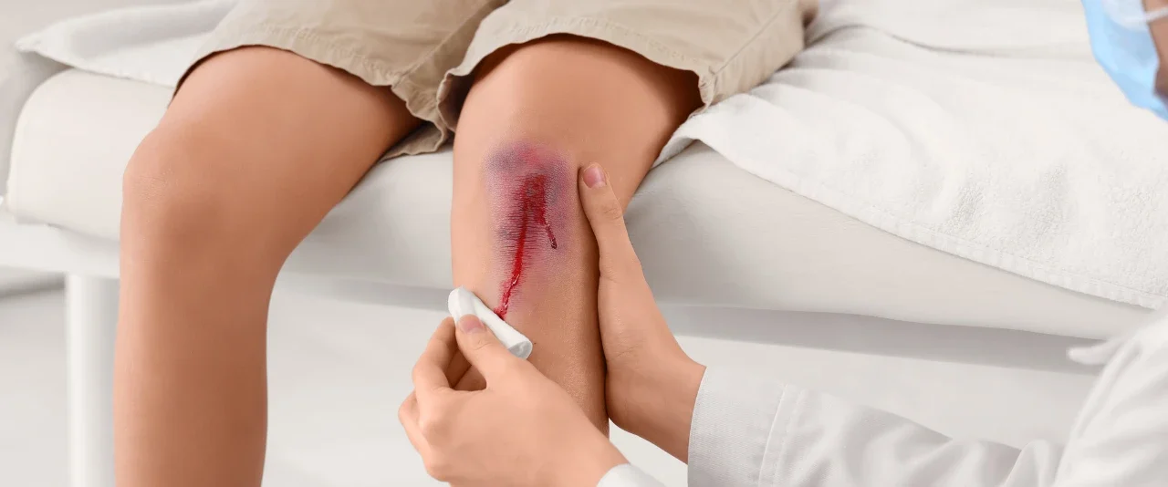 ชุดทำแผลปลอดเชื้อ