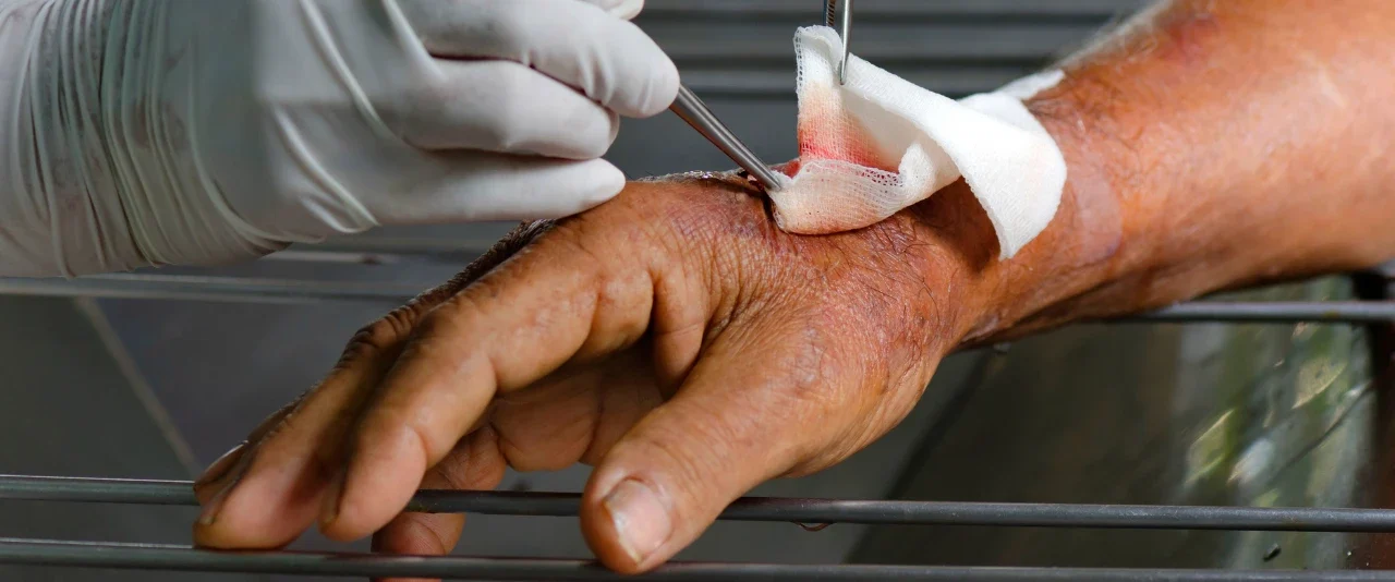 ชุดทำแผลปลอดเชื้อ