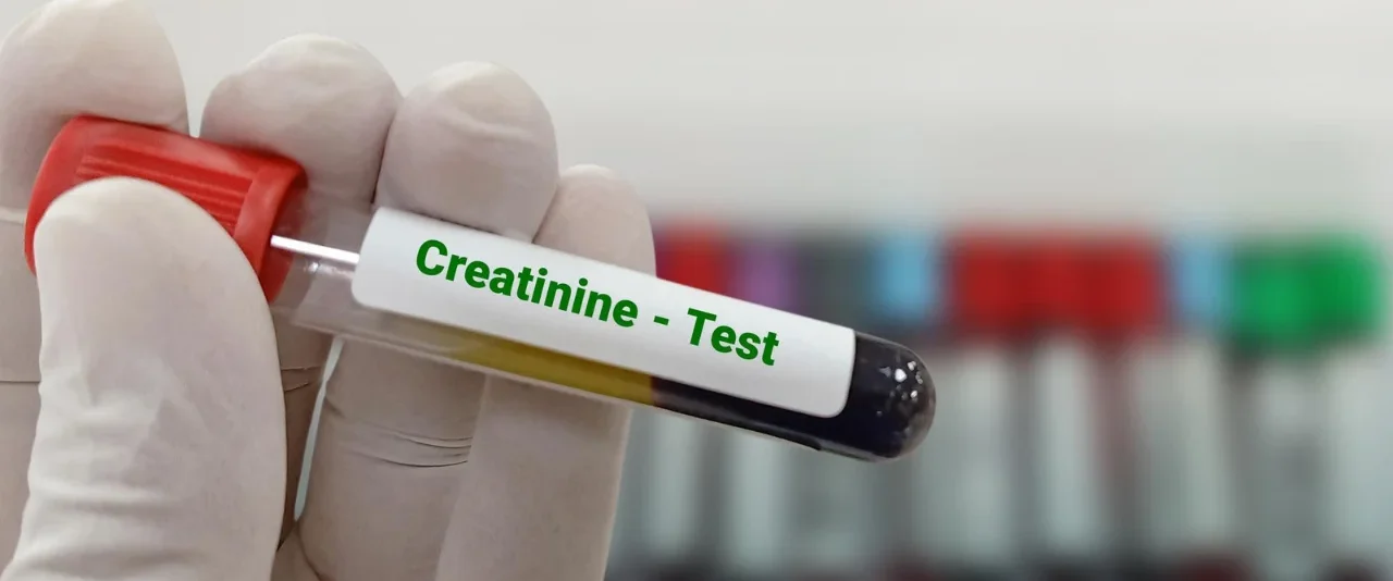 ชุดตรวจกัญชา